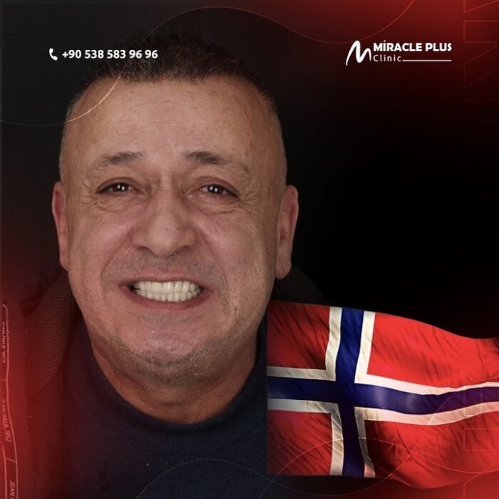 Impressive results of #cosmetic_dentistry at #miracle_plus_clinic ❤️What are you waiting forGet